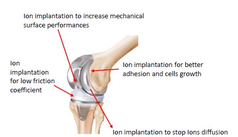 implant